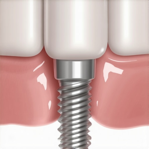 Why your dental implant crown feels loose but the screw is tight