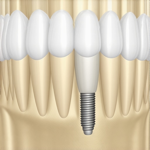A detailed 3D dental scan showing jawbone density for implant planning.
