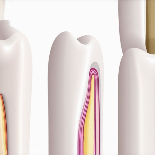 Veneer Emergence Profile Architecture Diagram showing correct veneer margin vs bulky over-contoured margin