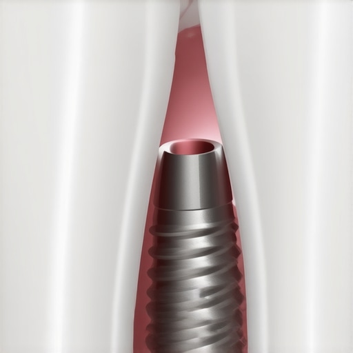 Why your dental implant crown feels like it is wiggling